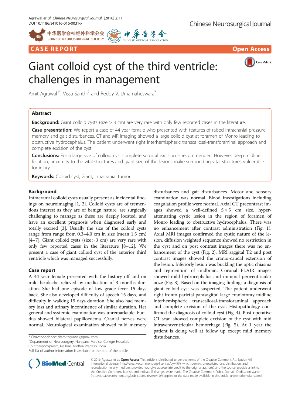 988x1313  Я начал этот Человека-паука на бумаге, они отнесли его в Procrea... | ТИК Так