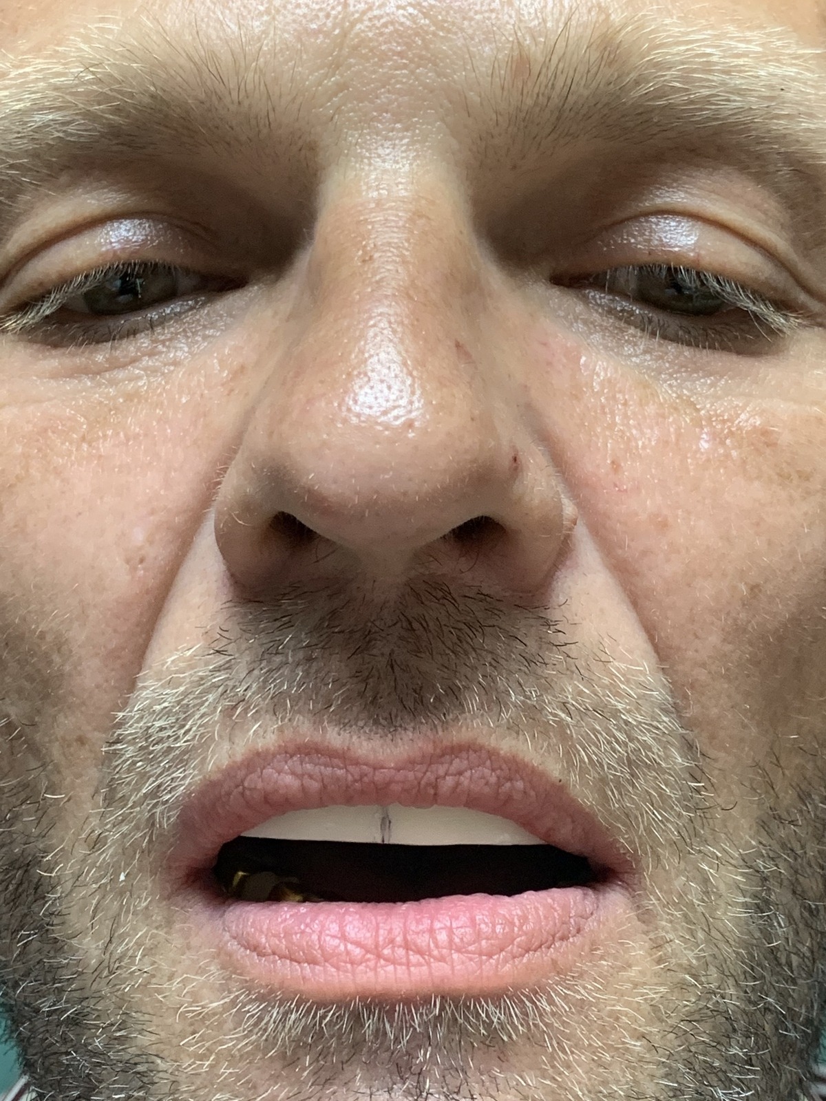 1200x1600  Адентия – Калибра