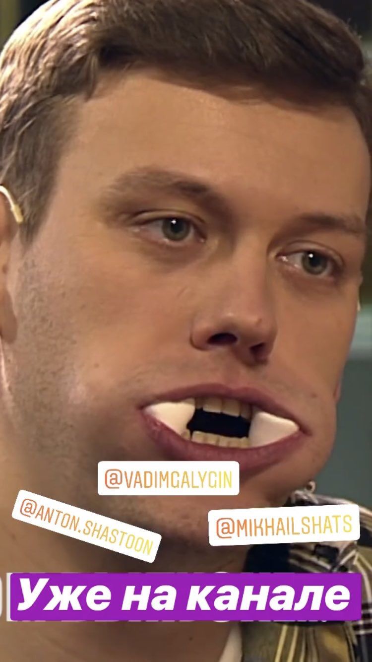 750x1334  У меня дыра в подбородке!»: трансгендерная «живая Барби» пострадала от  пластики