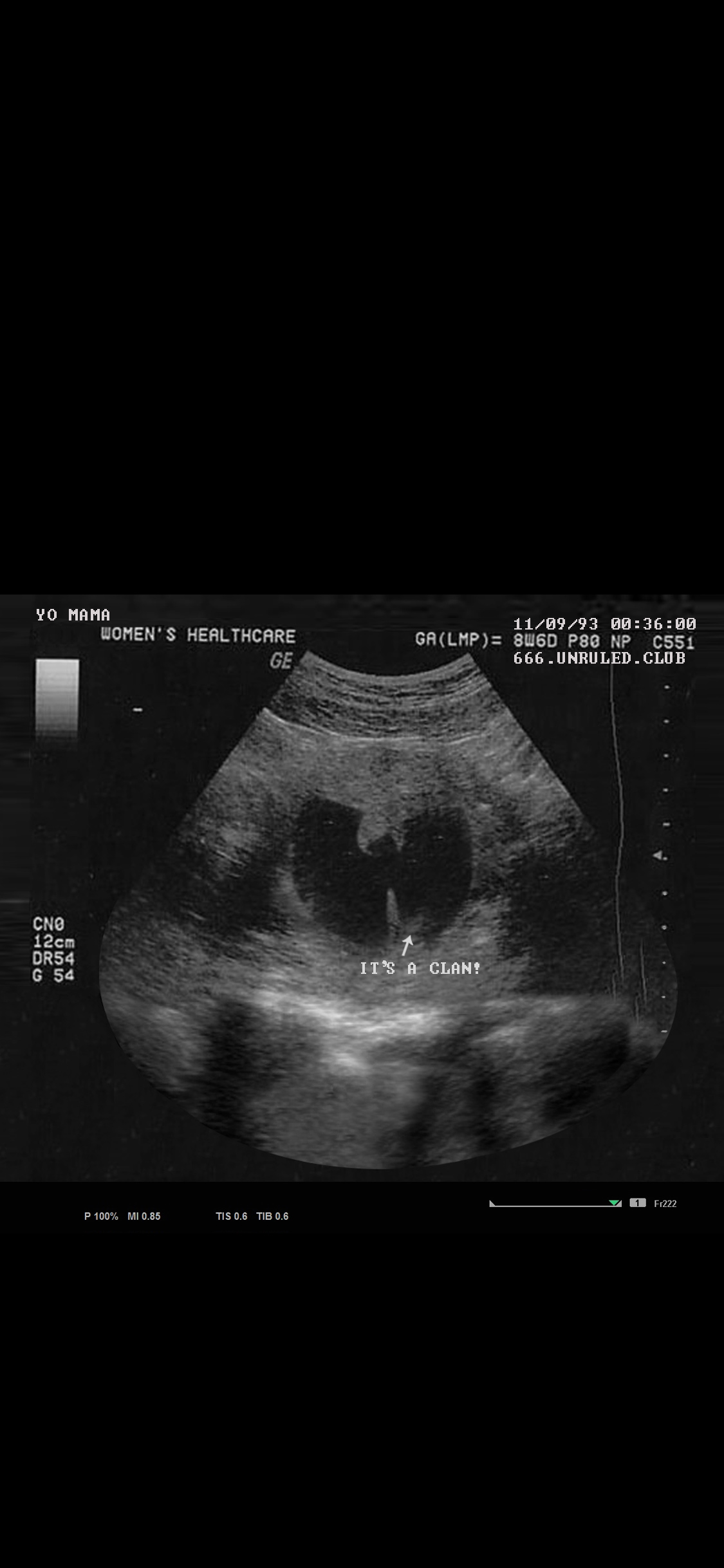 1125x2436   обои для мобильного телефона и обои для экрана блокировки! 